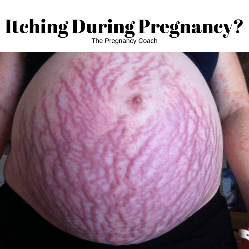 Itching During Pregnancy Ciaran